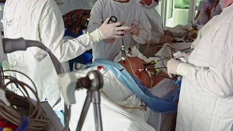 Operating. Laparoscopic surgery. Close-up. Stock Footage 77398059