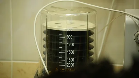 Operating room, life-saving operation, device delivers oxygen to patient's lungs Stock Footage 128281177