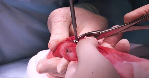 In the operating room, a veterinary surgeon attaches a titanium plate to a Stock Footage 238862750