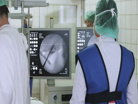 Operating room. X-ray control of a surgical operation. Stock Footage 73885675