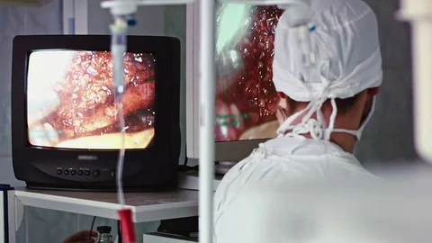 Operating. Surgery. Vídeo Stock 77397453