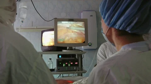 Operating. Surgery. Stock Footage