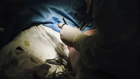 Operating. Surgery. Heart surgery. Vídeo Stock 77385040