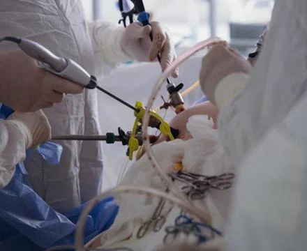 Operating. Surgery.  Laparoscopic surgery. Close-up. Stock Photos