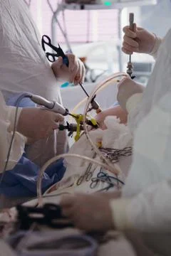 Operating. Surgery.  Laparoscopic surgery. Close-up. Stock Photos