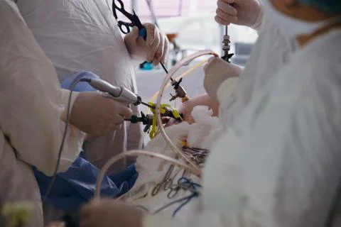 Operating. Surgery. Laparoscopic surgery. Close-up. Stock Photos