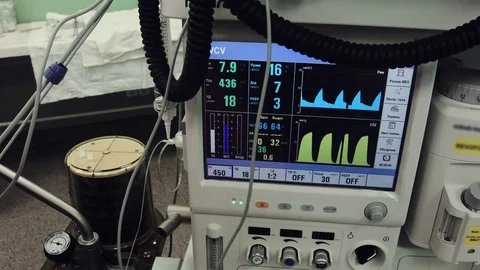 Operating. Surgery. Vital statistics. Stock Footage 77385029