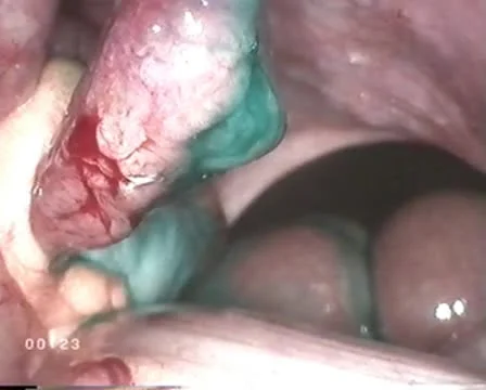 Operating table Stock Footage 9666110