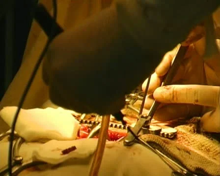 Operating table Stock Footage 10868022