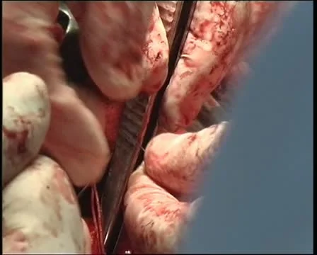 Operating table 스톡 동영상 11359218