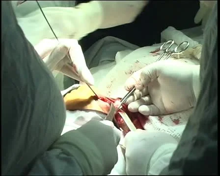 Operating table Stock Footage 11359236