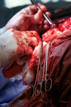 Operation details Stockfoto's