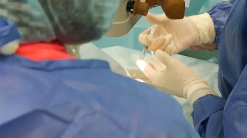 Operation on the eye, cataract surgery. Surgeon hands in gloves performing laser Stock Footage 127937015