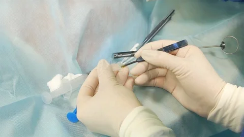 Operation on the eye, cataract surgery. Surgeon hands in gloves performing laser Stock Footage 127997879