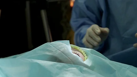 The operation on the eye Stock Footage 99657166