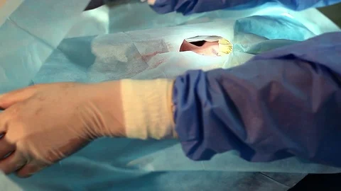 Operation on the eye Stock Footage 100333297