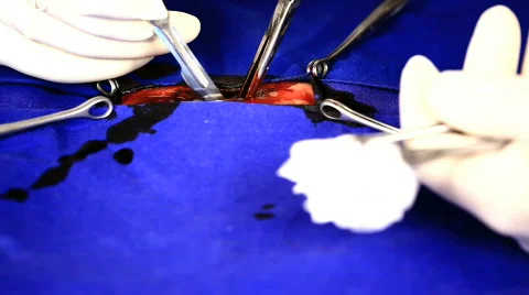 Operation 스톡 동영상 779675