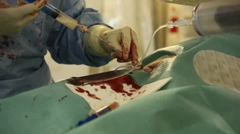 Operation Stock Footage 7130684