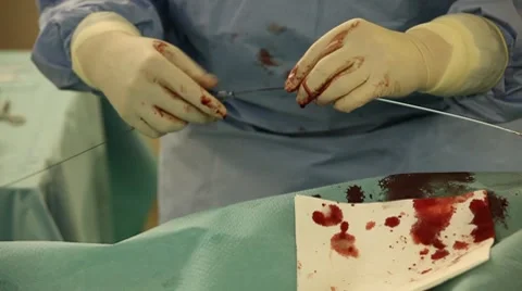 Operation Видео 7130757