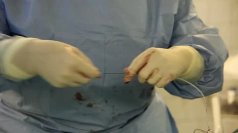 Operation Vidéo 7130782