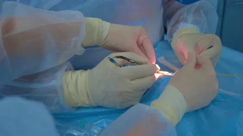 Operation Stock Footage 163364873