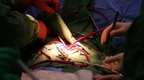 Operation on a heart Video stock 977958