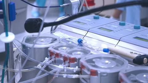 Operation of a heart-lung machine in the operating room during heart surgery Stock Footage 253803787