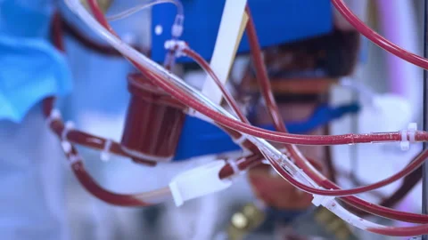 Operation of a heart-lung machine in the operating room during heart surgery Stock Footage 255151010