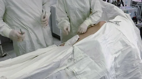 Operation. Laparoscopic surgery. Preparing for an operation. Vídeo Stock 77397572