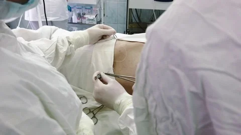 Operation. Laparoscopic surgery. Preparing for an operation. Stock Footage 77397813