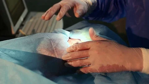 Operation of laser vision correction Stock Footage 99656764