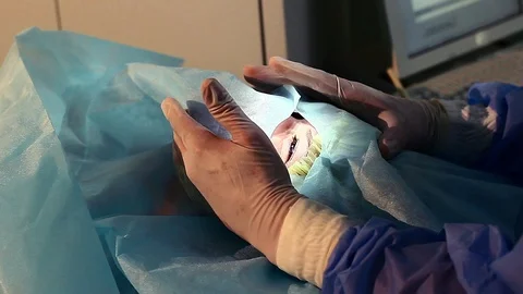 Operation of laser vision correction Video stock 99797849