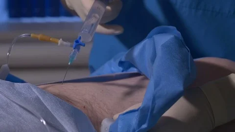 The operation on the leg close-up Stock Footage 73576118