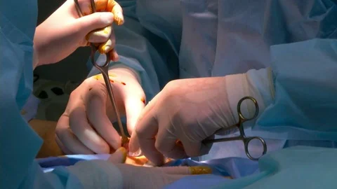 Operation on the leg implant inserted Stockbeeldmateriaal 70662741