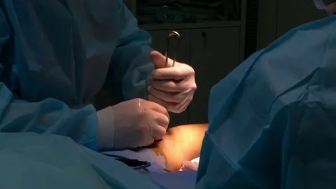 Operation on the leg implant inserted Stock Footage 71338457