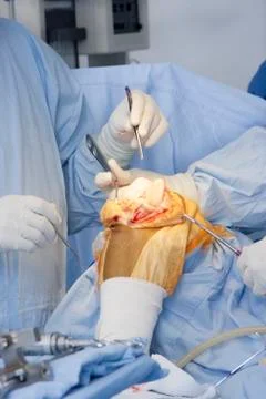 Operation Stock Photos