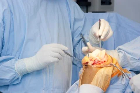 Operation Stock Photos