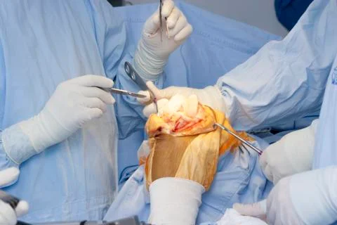 Operation Stock Photos