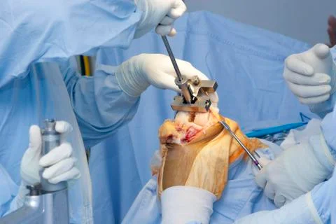 Operation Stock Photos