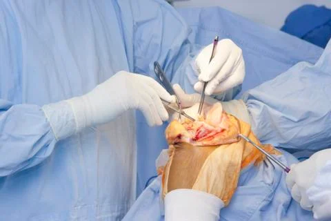 Operation Stock Photos