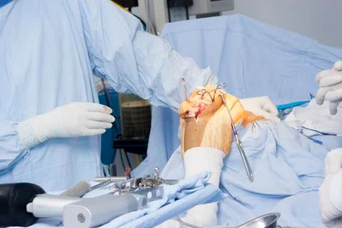 Operation Stock Photos