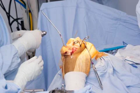 Operation Stock Photos