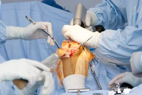 Operation 스톡 사진