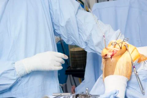 Operation Stock Photos