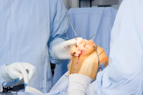 Operation Stock Photos