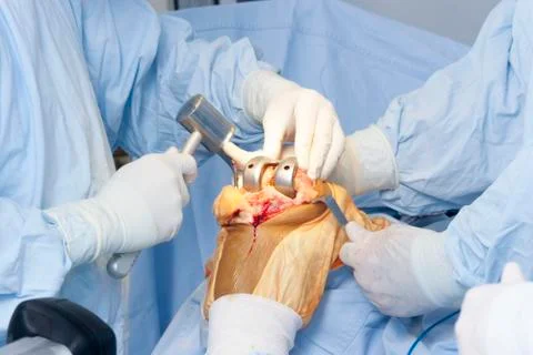 Operation Stock Photos