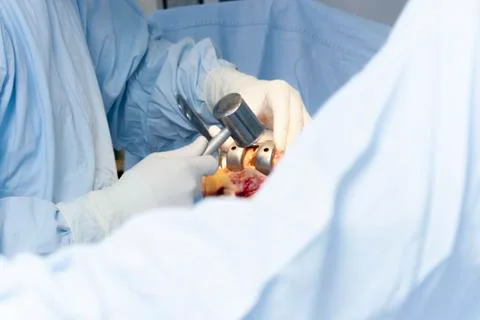 Operation Stock Photos