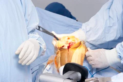 Operation Stock Photos