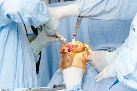 Operation Stock Photos