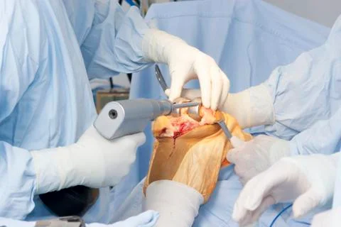 Operation Stock Photos